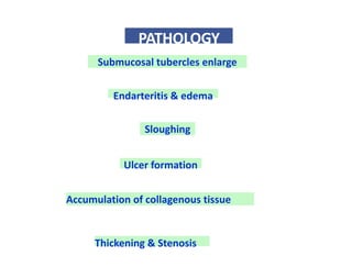 PATHOLOGY
Submucosal tubercles enlarge
Endarteritis & edema
Sloughing
Ulcer formation
Accumulation of collagenous tissue
Thickening & Stenosis
 
