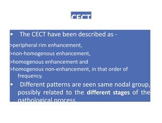 CECT
• The CECT have been described as -
>peripheral rim enhancement,
>non-homogenous enhancement,
>homogenous enhancement and
>homogenous non-enhancement, in that order of
frequency.
• Different patterns are seen same nodal group,
possibly related to the different stages of the
pathological process.
 