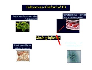 PathogenesisofabdominalTB
Ingestion of contaminated
milk products
Hematogenous spread
from pulmonary focus
Direct spread from
adjacent organs
 Swallowing of
infected sputum
 