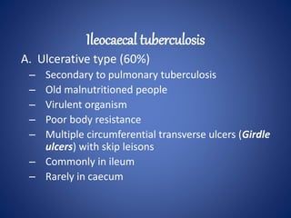 A. Ulcerative type (60%)
– Secondary to pulmonary tuberculosis
– Old malnutritioned people
– Virulent organism
– Poor body resistance
– Multiple circumferential transverse ulcers (Girdle
ulcers) with skip leisons
– Commonly in ileum
– Rarely in caecum
Ileocaecal tuberculosis
 