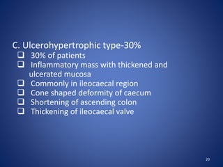 20
 30% of patients
 Inflammatory mass with thickened and
ulcerated mucosa
 Commonly in ileocaecal region
 Cone shaped deformity of caecum
 Shortening of ascending colon
 Thickening of ileocaecal valve
C. Ulcerohypertrophic type-30%
 