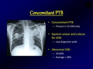 Concomitant PTB
• Concomitant PTB
– Present in 15-25% only
• Sputum smear and culture
for AFB:
– Low diagnostic yield
• Abnormal CXR:
– 19-83%
– Average = 38%
 