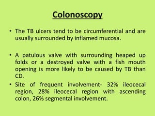Colonoscopy
• The TB ulcers tend to be circumferential and are
usually surrounded by inflamed mucosa.
• A patulous valve with surrounding heaped up
folds or a destroyed valve with a fish mouth
opening is more likely to be caused by TB than
CD.
• Site of frequent involvement- 32% ileocecal
region, 28% ileocecal region with ascending
colon, 26% segmental involvement.
 