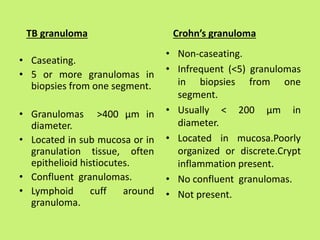 TB granuloma
• Caseating.
• 5 or more granulomas in
biopsies from one segment.
• Granulomas >400 µm in
diameter.
• Located in sub mucosa or in
granulation tissue, often
epithelioid histiocutes.
• Confluent granulomas.
• Lymphoid cuff around
granuloma.
Crohn’s granuloma
• Non-caseating.
• Infrequent (<5) granulomas
in biopsies from one
segment.
• Usually < 200 µm in
diameter.
• Located in mucosa.Poorly
organized or discrete.Crypt
inflammation present.
• No confluent granulomas.
• Not present.
 