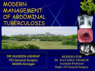 MODERN
MANAGEMENT
OF ABDOMINAL
TUBERCULOSIS
DR WASEEM ASHRAF
PG General Surgery
SKIMS-Srinagar
MODERATOR
Dr NATASHA THAKUR
Assistant Professor
Deptt. Of General Surgery
 