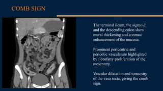 Abdominal Tuberculosis: Imaging Challenges and Differential Diagnosis ...
