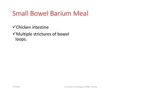 Small Bowel Barium Meal
Chicken intestine
Multiple strictures of bowel
loops.
7/7/2015 Dr.S.K.Jain, Prof Surgery, MAMC, N.Delhi
 
