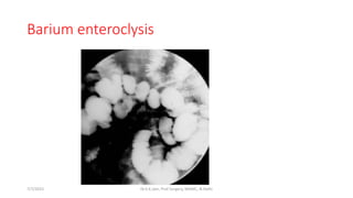 Barium enteroclysis
7/7/2015 Dr.S.K.Jain, Prof Surgery, MAMC, N.Delhi
 