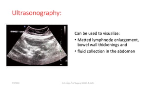 Ultrasonography:
Can be used to visualize:
• Matted lymphnode enlargement,
bowel wall thickenings and
• fluid collection in the abdomen
7/7/2015 Dr.S.K.Jain, Prof Surgery, MAMC, N.Delhi
 