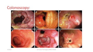 Colonoscopy:
7/7/2015 Dr.S.K.Jain, Prof Surgery, MAMC, N.Delhi
 