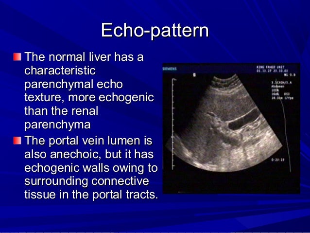 Abdominal us &amp; its different applications