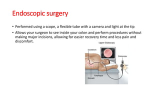 Endoscopic surgery
• Performed using a scope, a flexible tube with a camera and light at the tip
• Allows your surgeon to see inside your colon and perform procedures without
making major incisions, allowing for easier recovery time and less pain and
discomfort.
 