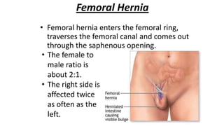 Abdominal wall and hernia By Dr Yousef Shehada.pptx
