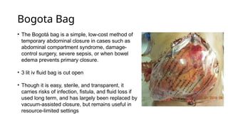 ABDOMINAL WALL abdominal-wall