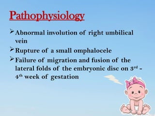 abdominal wall defect in child health nursing | PPTX