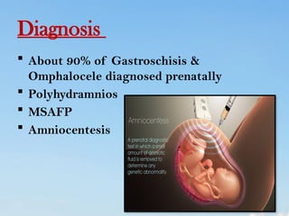 abdominal wall defect in child health nursing | PPTX