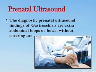 abdominal wall defect in child health nursing | PPTX