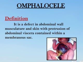 abdominal wall defect in child health nursing | PPTX