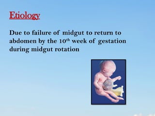 abdominal wall defect in child health nursing | PPTX