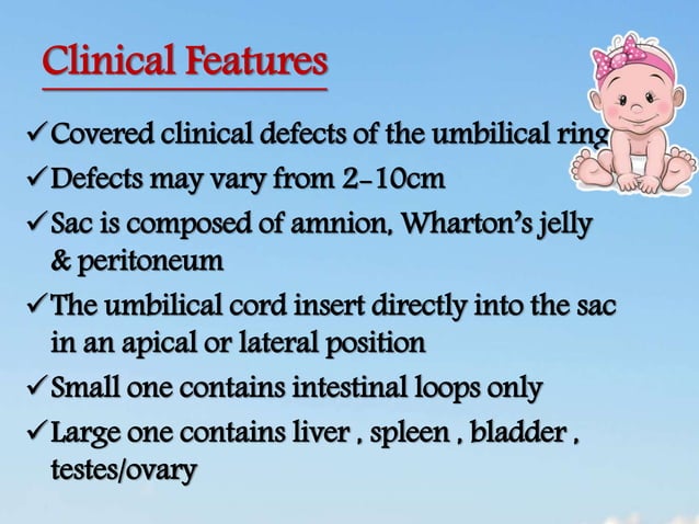 Abdominal wall defect | PPTX