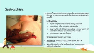 Gastroschisis
 มีอวัยวะในช่องท้องยื่น ออกจากช่องโหว่ของผนัง หน้าท้อง
มักอยู่ด้านขวา ของสายสะดือโดยมีแถบ ของผิวหนังกั้น
ขวางไว้
 Embryology
1. Right omphalomesenteric artery accident
2. lateral fold ปิดไม่ สมบูรณ์ ช่วงสัปดาห์ที่ 4
3. ประมาณสัปดาห์ที่ 4 Right Umbilical vein สลายไปทา ให้
ผนังหน้าท้องส่วนนั้น ขาดตัวหนุนความ แข็งแรง
4. ถุง omphalocele แตก ในครรภ์
 Onset presentation: แรกคลอด
• Incidence: 1/6000-10000 live birth, M > F
• เพิ่มอุบัติการณ์การเกิด กรดไหลย้อนเข้าหลอดอาหาร,
midgut volvulus
 