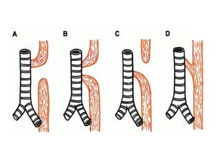 ABDOMINAL WALL DEFECTS.pptx