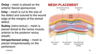 Sublay Retrorectus definitions, Anatomy , classifications and managements | PPTX