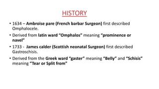 Abdominal wall defects (dr.tanvir) | PPTX