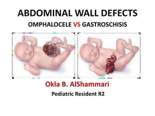 ABDOMINAL WALL DEFECTS
OMPHALOCELE VS GASTROSCHISIS
Okla B. AlShammari
Pediatric Resident R2
 