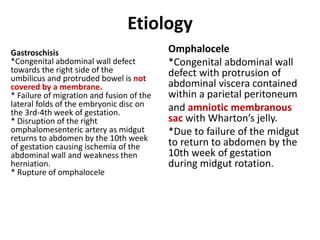 Etiology
Omphalocele
*Congenital abdominal wall
defect with protrusion of
abdominal viscera contained
within a parietal peritoneum
and amniotic membranous
sac with Wharton’s jelly.
*Due to failure of the midgut
to return to abdomen by the
10th week of gestation
during midgut rotation.
Gastroschisis
*Congenital abdominal wall defect
towards the right side of the
umbilicus and protruded bowel is not
covered by a membrane.
* Failure of migration and fusion of the
lateral folds of the embryonic disc on
the 3rd-4th week of gestation.
* Disruption of the right
omphalomesenteric artery as midgut
returns to abdomen by the 10th week
of gestation causing ischemia of the
abdominal wall and weakness then
herniation.
* Rupture of omphalocele
 