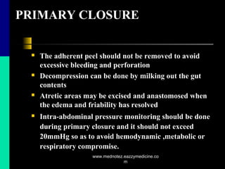 PRIMARY CLOSURE
 The adherent peel should not be removed to avoid
excessive bleeding and perforation
 Decompression can be done by milking out the gut
contents
 Atretic areas may be excised and anastomosed when
the edema and friability has resolved
 Intra-abdominal pressure monitoring should be done
during primary closure and it should not exceed
20mmHg so as to avoid hemodynamic ,metabolic or
respiratory compromise.
www.mednotez.eazzymedicine.co
m
 