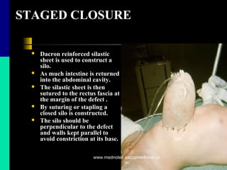 STAGED CLOSURE
 Dacron reinforced silastic
sheet is used to construct a
silo.
 As much intestine is returned
into the abdominal cavity.
 The silastic sheet is then
sutured to the rectus fascia at
the margin of the defect .
 By suturing or stapling a
closed silo is constructed.
 The silo should be
perpendicular to the defect
and walls kept parallel to
avoid constriction at its base.
www.mednotez.eazzymedicine.co
m
 