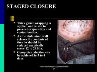 STAGED CLOSURE
 Thick gauze wrapping is
applied on the silo to
prevent evaporation and
contamination.
 As the abdominal wall
relaxes the contents of
the silo should be
reduced aseptically
every 12 to 24 Hrs.
 Complete reduction can
be achieved in 3 to 4
days.
www.mednotez.eazzymedicine.co
m
 