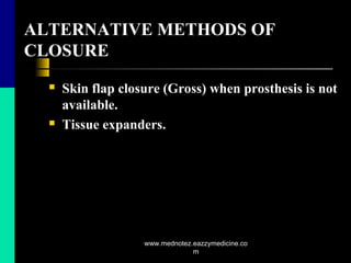 ALTERNATIVE METHODS OF
CLOSURE
 Skin flap closure (Gross) when prosthesis is not
available.
 Tissue expanders.
www.mednotez.eazzymedicine.co
m
 