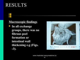 RESULTS
Macroscopic findings
 In all exchange
groups, there was no
fibrous peel
formation or
intestinal wall
thickening e.g (Figs.
-3).
www.mednotez.eazzymedicine.co
m
 
