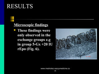 RESULTS
Microscopic findings
 These findings were
only observed in the
exchange groups e.g
in group 5-Gx +20 IU
rEpo (Fig. 6).
www.mednotez.eazzymedicine.co
m
 