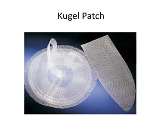 Kugel Patch
 