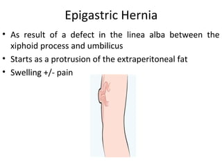Epigastric Hernia
• As result of a defect in the linea alba between the
xiphoid process and umbilicus
• Starts as a protrusion of the extraperitoneal fat
• Swelling +/- pain
 