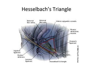 Hesselbach’s Triangle
 