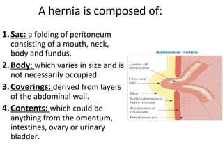 A hernia is composed of:
1.Sac: a folding of peritoneum
consisting of a mouth, neck,
body and fundus.
2.Body: which varies in size and is
not necessarily occupied.
3.Coverings: derived from layers
of the abdominal wall.
4.Contents: which could be
anything from the omentum,
intestines, ovary or urinary
bladder.
 