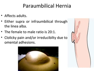 Paraumbilical Hernia
• Affects adults.
• Either supra or infraumbilical through
the linea alba.
• The female to male ratio is 20:1.
• Clolicky pain and/or irreducibilty due to
omental adhesions.
 