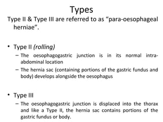 Types
Type II & Type III are referred to as “para-oesophageal
herniae”.
• Type II (rolling)
– The oesophagogastric junction is in its normal intra-
abdominal location
– The hernia sac (containing portions of the gastric fundus and
body) develops alongside the oesophagus
• Type III
– The oesophagogastric junction is displaced into the thorax
and like a Type II, the hernia sac contains portions of the
gastric fundus or body.
 