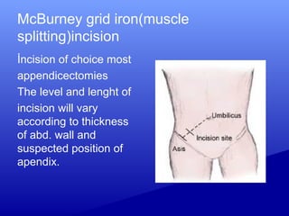 McBurney grid iron(muscle
splitting)incision
İncision of choice most
appendicectomies
The level and lenght of
incision will vary
according to thickness
of abd. wall and
suspected position of
apendix.
 