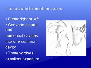 Thoracoabdominal Incisions
• Either right or left
• Converts pleural
and
peritoneal cavities
into one common
cavity
• Thereby gives
excellent exposure
 