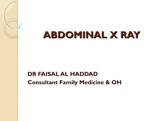 ABDOMINAL X RAYABDOMINAL X RAY
DR FAISAL AL HADDAD
Consultant Family Medicine & OH
 
