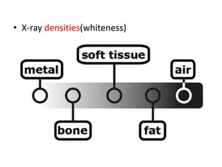 • X-ray densities(whiteness)
 