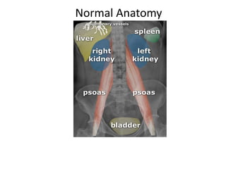 Normal Anatomy
 