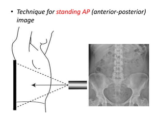• Technique for standing AP (anterior-posterior)
image
 