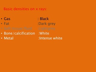 Basic densities on x rays:
• Gas : Black
• Fat :Dark grey
• Soft tissue/fluid :Lightgrey
• Bone/calcification :White
• Metal :Intense white
 