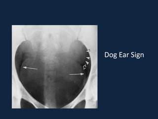 Dog Ear Sign Radiograph Introduction to Abdominal x ray | PPTX
